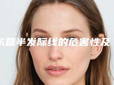 东营半发际线的危害性及护理事项