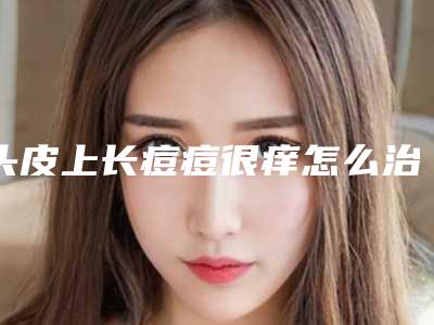 头皮上长痘痘很痒怎么治疗,头皮上长痘痘特别痒