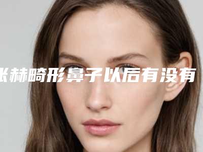 张赫畸形鼻子以后有没有副作用
